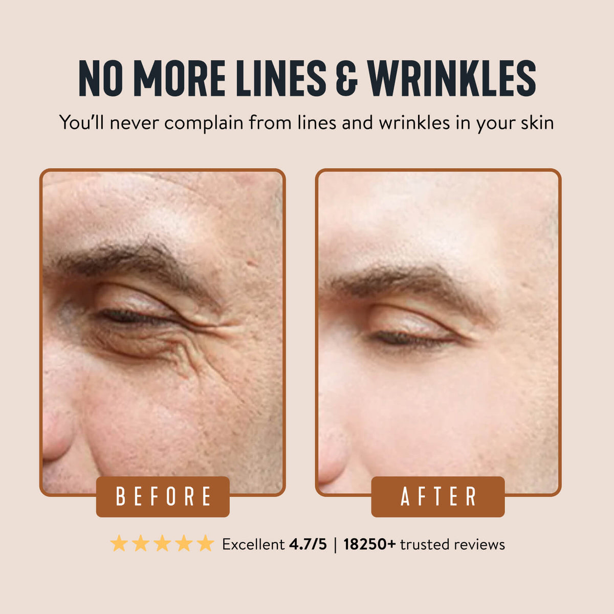 Wrinkle Defense Tallow Balm